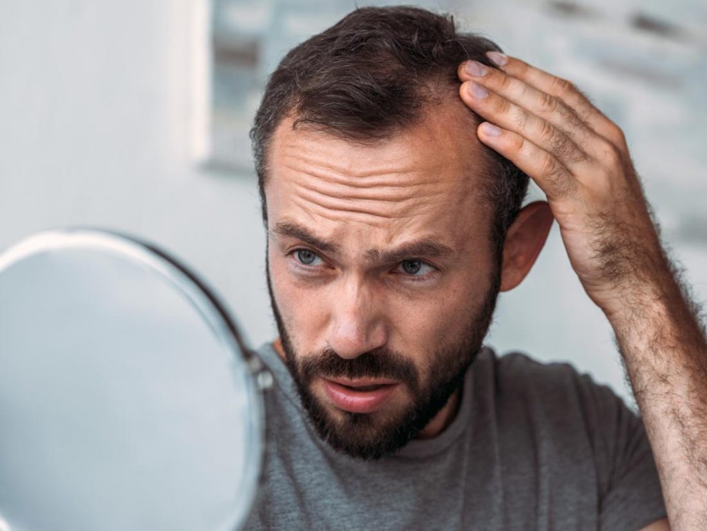 a-man-experiencing-hair-loss-because-of-a-problem-with-his-thyroid-1024×769